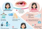   Bài truyền thông về bệnh đau mắt đỏ